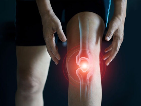 Watch: Russian Electrical Stimulation for Knee Pain Relief