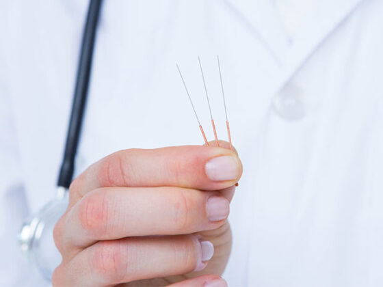 Acupuncture for Tinnitus: Does it Actually Help?